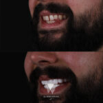 Quadro Dental patient before and after dental treatment