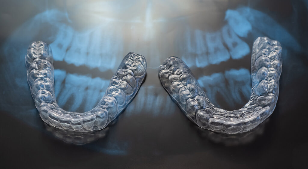 Clear Invisalign aligners placed over a dental X-ray background – Invisalign Turkey